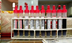 W Malczycach w październiku odbędzie się zbiórka krwi