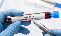 Udanin: jeden z pracowników urzędu ma pozytywny wynik na obecność wirusa