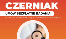 Bezpłatne badania w kierunku czerniaka dla mieszkańców Gminy Udanin