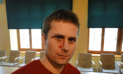 Rusza proces o pobicie dziennikarza ze Środy Śląskiej