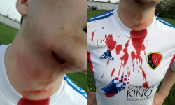 Dantejskie sceny na meczu B-klasy. Kibice wtargnęli na murawę. Polała się krew [AKTUALIZACJA]