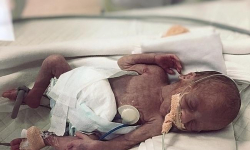 Ratujemy Helenkę ze Środy Śląskiej. Brakuje ponad 100 tysięcy, aby wróciła do domu